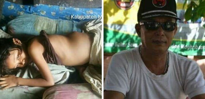 Aktivis Sosial : Iskandar Hasibuan,  Fitri Sakit Tumor Dibiarkan Tidak Berobat Karena Miskin