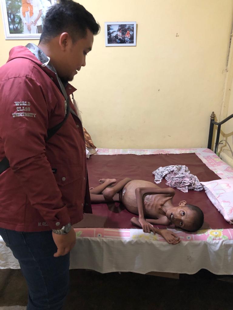 Juan Siswa SD Berprestasi Menderita Tumor Di Perut, Butuh Bantuan Dermawan