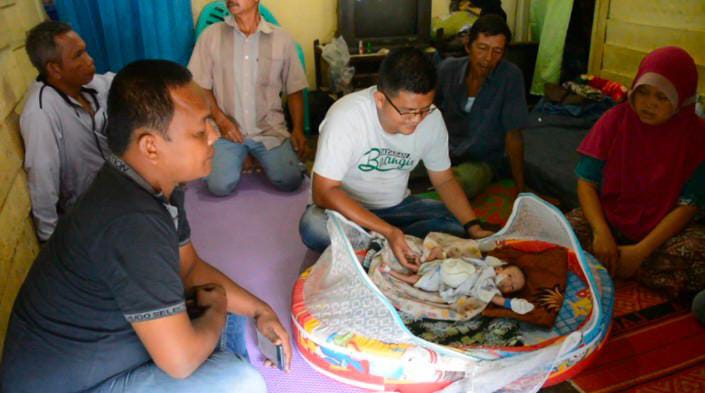 Bayi Penderita Omfalokel di Sitamiang Baru Kota P.Sidimpuan Butuh Uluran Tangan