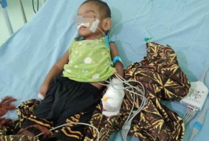 Kasihan..!!! Balita Gizi Buruk dan TB Paru Warga Madina Membutuhkan Pertolongan